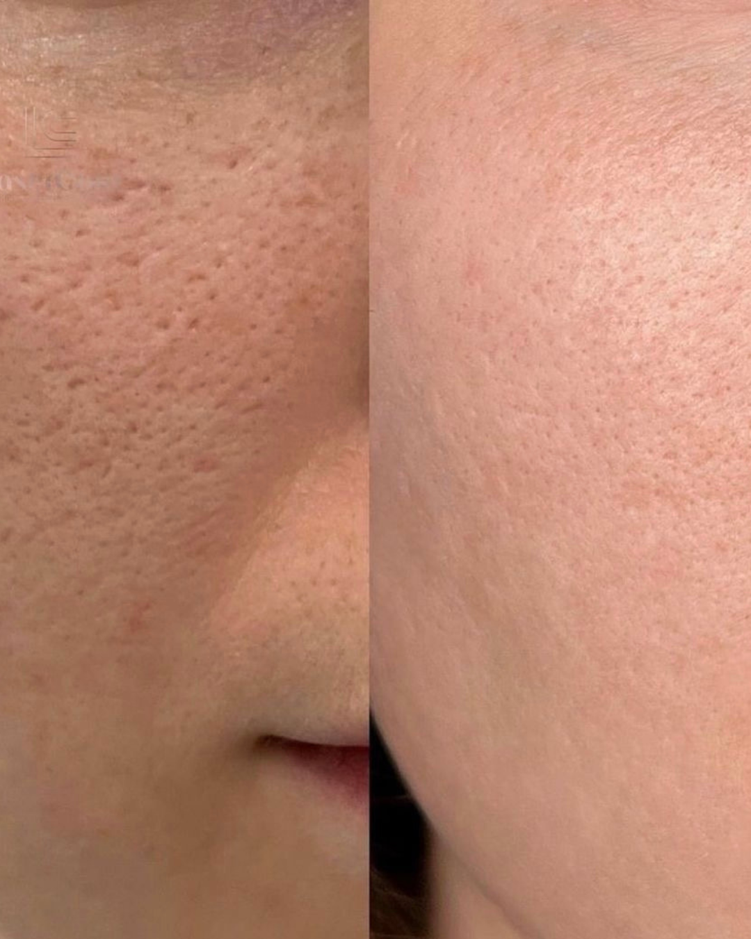 PURE ROSE TONER